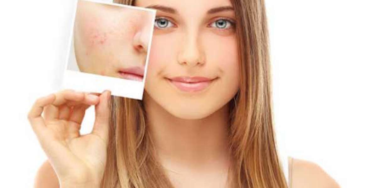 Best Skin Care Tips For Women| 100% Natural Ingredients|Lavish Grace Cream!