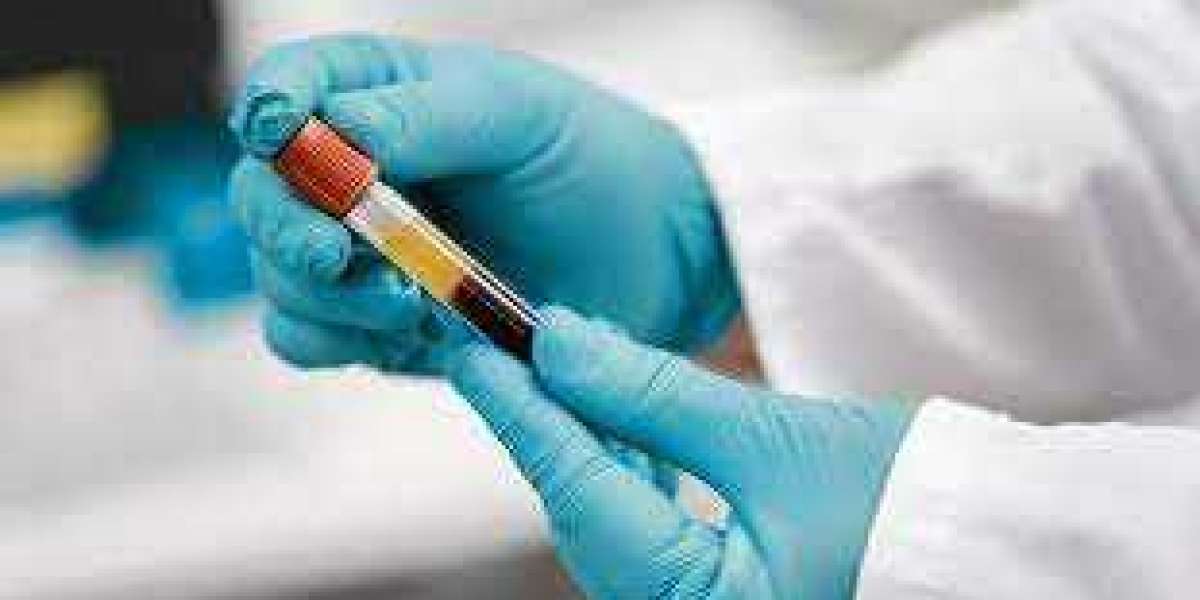 The Benefits of Having A Blood test
