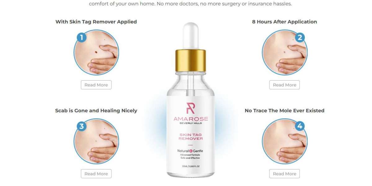 Amarose Skin Tag Remover Benefits & How To Order At Offer Cost In USA?