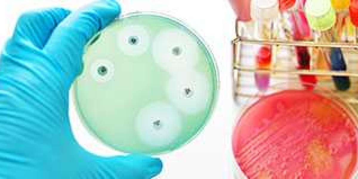 Antimicrobial Susceptibility Testing Market Size by 2025