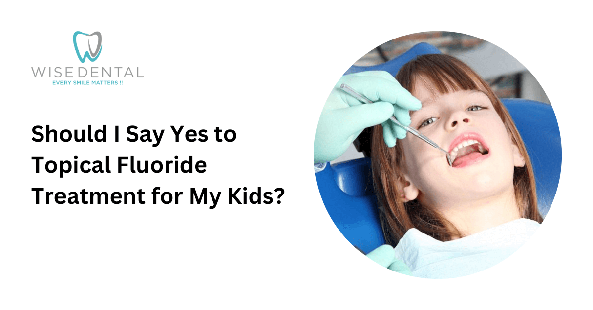 Should I Say Yes to Topical Fluoride Treatment for My Kids? - Wise Dental