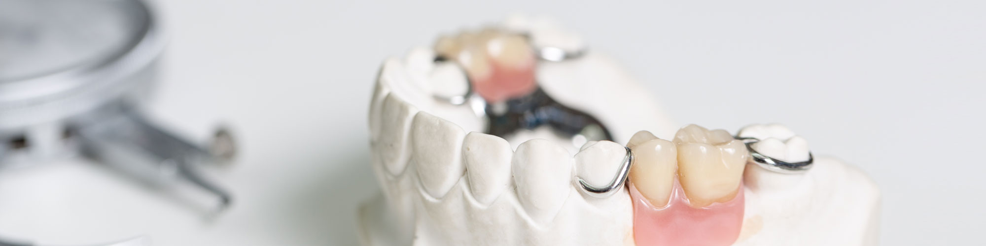 Dental Crowns and Bridges | Dental Crowns Cost