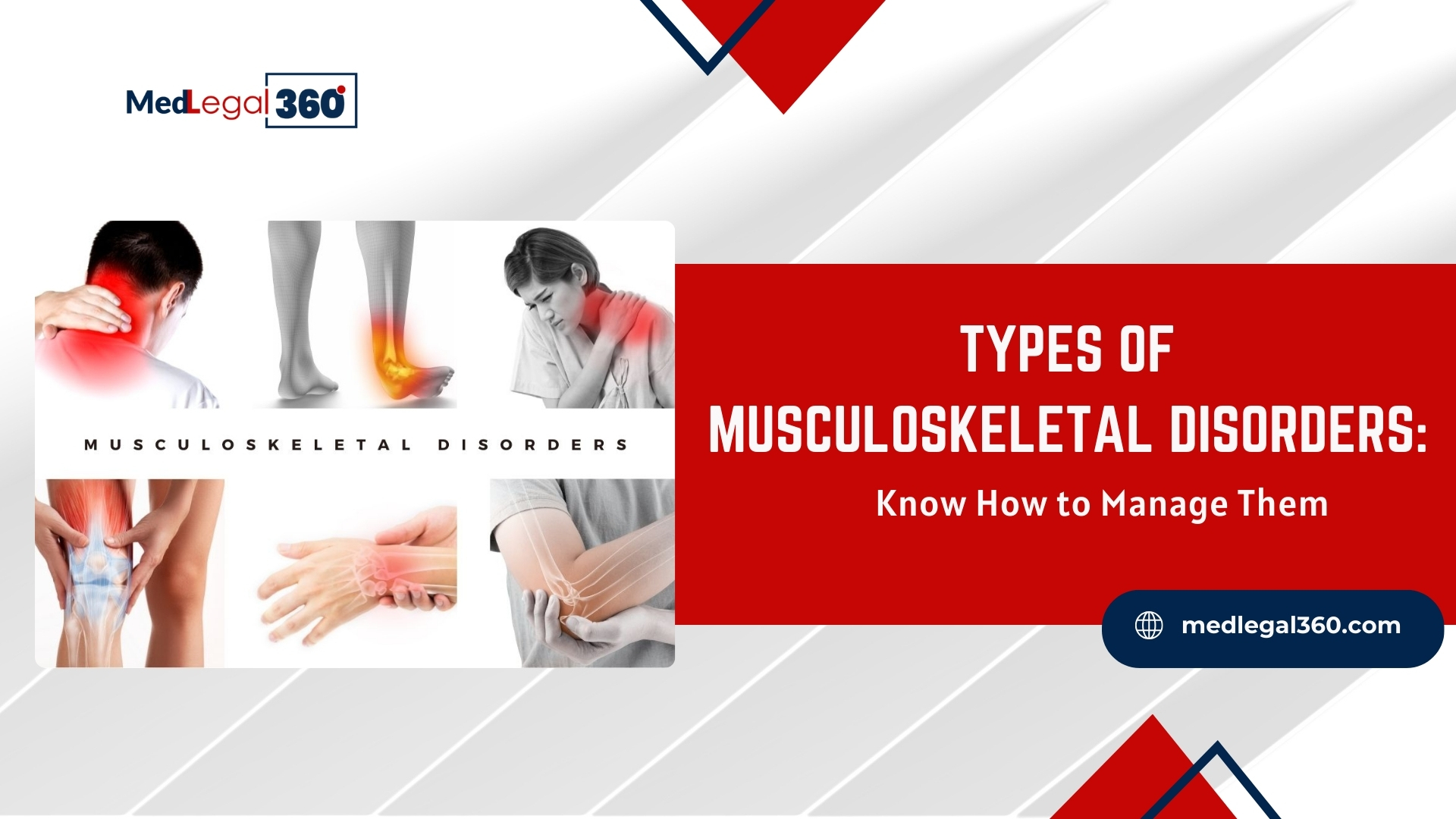 Types of Musculoskeletal Disorders: Know How to Manage Them